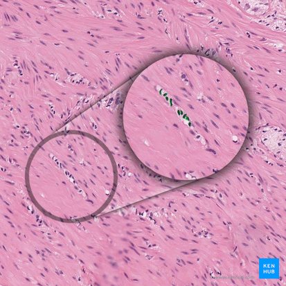Nucleus fibroblasti (Fibroblastenzellkern); Bild: 