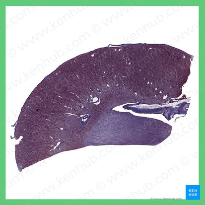 Kidney (Ren); Image: 