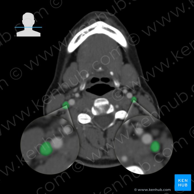 Veia jugular interna (Vena jugularis interna); Imagem: 