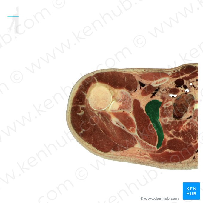 Serratus anterior muscle (Musculus serratus anterior); Image: National Library of Medicine