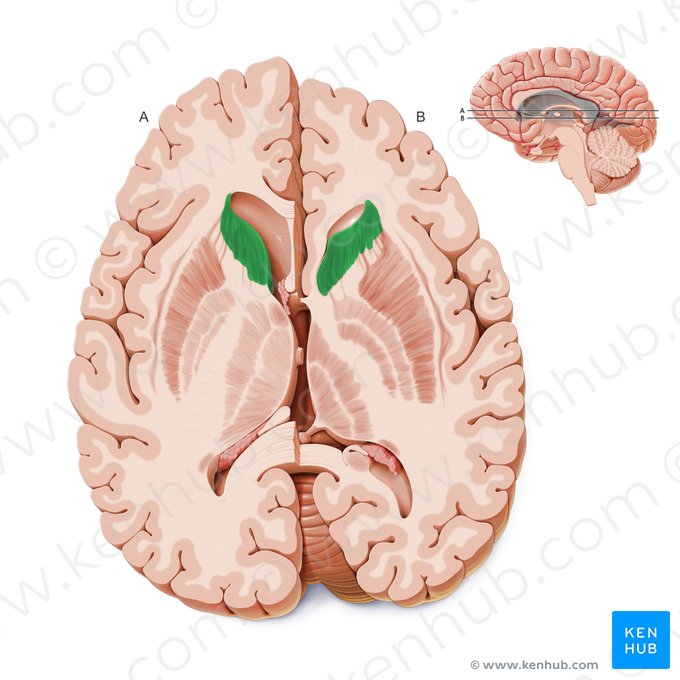 Head of caudate nucleus (Caput nuclei caudati); Image: Paul Kim