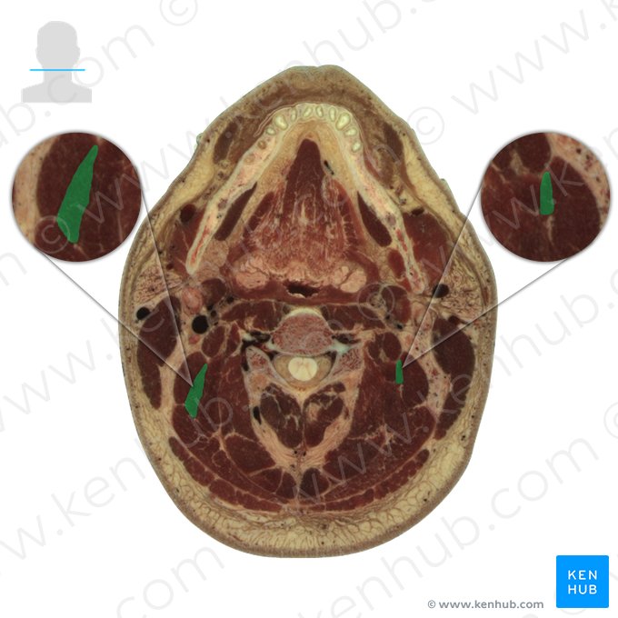 Musculus longissimus capitis (Kopfteil des langen Rückenmuskels); Bild: National Library of Medicine