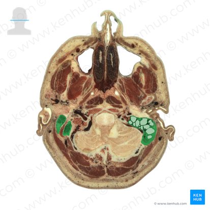 Mastoid process of temporal bone (Processus mastoideus ossis temporalis); Image: National Library of Medicine