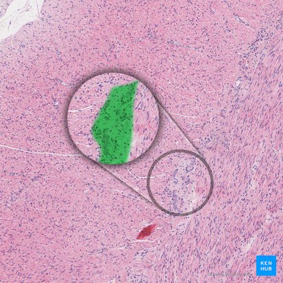 Myenteric plexus (of Auerbach) (Plexus myentericus); Image: 