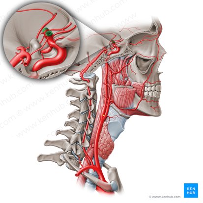 Arteria cerebral media (Arteria media cerebri); Imagen: Paul Kim