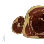 Cross sections of the upper extremity: Arm level