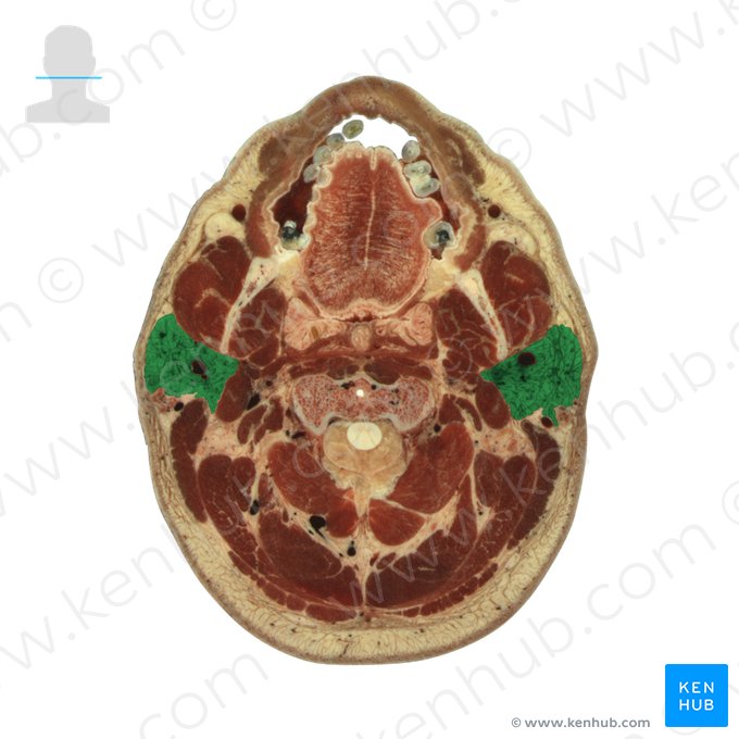 Glândula parótida (Glandula parotidea); Imagem: National Library of Medicine