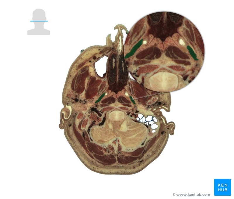 Levator veli palatini - axial view