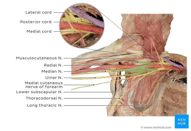 Brachial plexus and musculocutaneous nerve in a cadaver