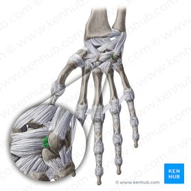 Palmar triquetrohamate ligament (Ligamentum triquetrohamatum palmare); Image: Yousun Koh