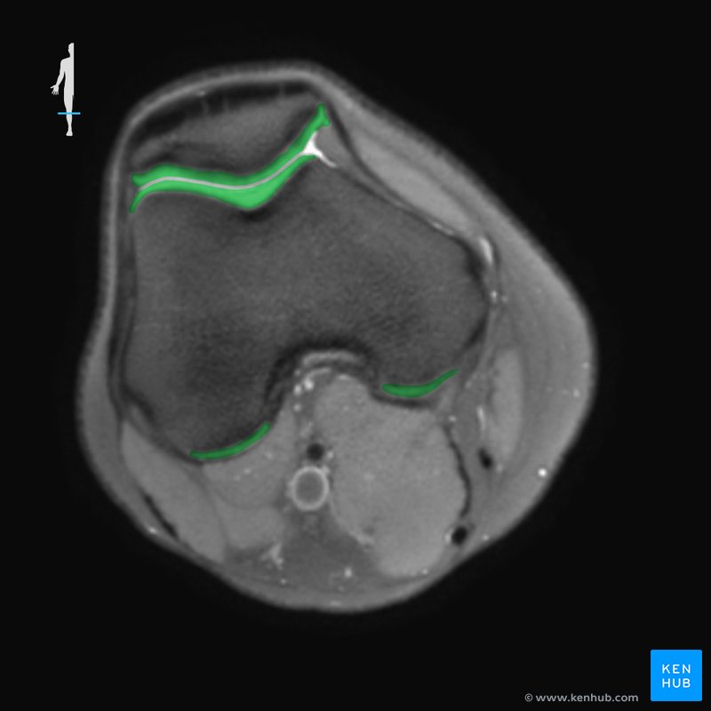 Normal knee MRI