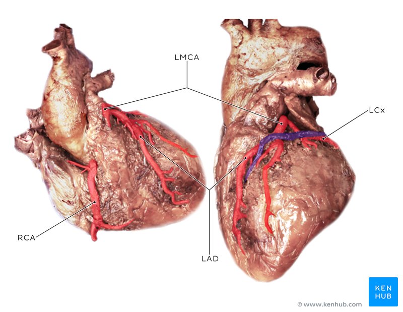 Coronary circulation in a cadaver