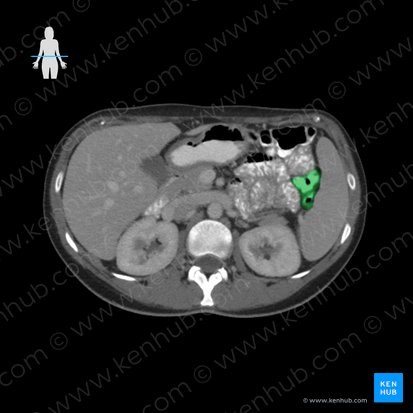 Descending colon (Colon descendens); Image: 