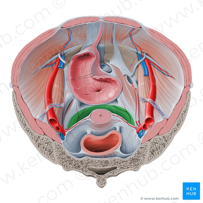 Vesicouterine pouch (Excavatio vesicouterina); Image: Paul Kim