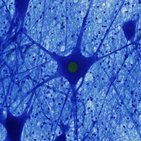 Neurona