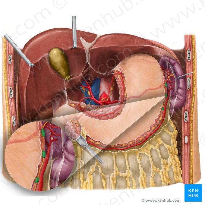 Ganglios linfáticos gastroomentales izquierdos (Nodi lymphoidei gastroomentales sinistri); Imagen: Begoña Rodriguez