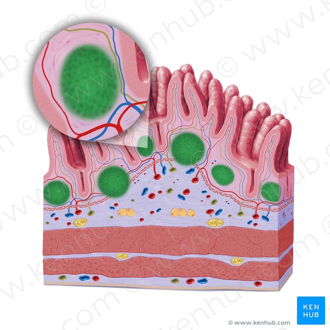 Aggregated lymphoid nodules of ileum (Peyer's patches) (Noduli lymphoidei aggregati ilei); Image: Paul Kim