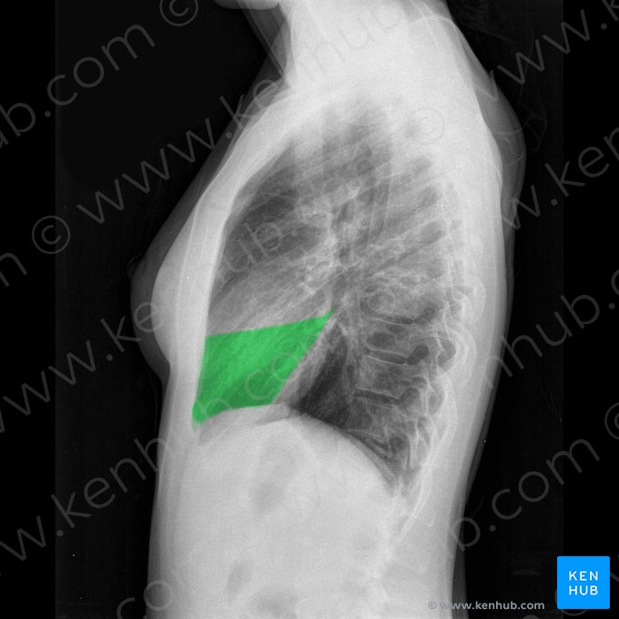 Lobo médio do pulmão direito (Lobus medius pulmonis dextri); Imagem: 