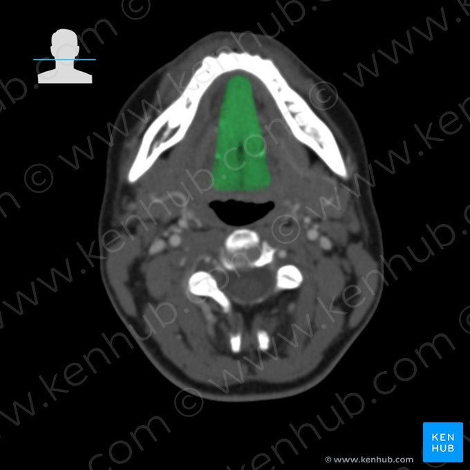 Músculo geniogloso (Musculus genioglossus); Imagen: 