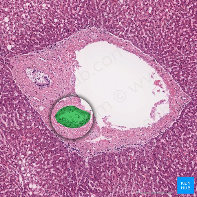 Interlobular artery (Arteria interlobularis); Image: 