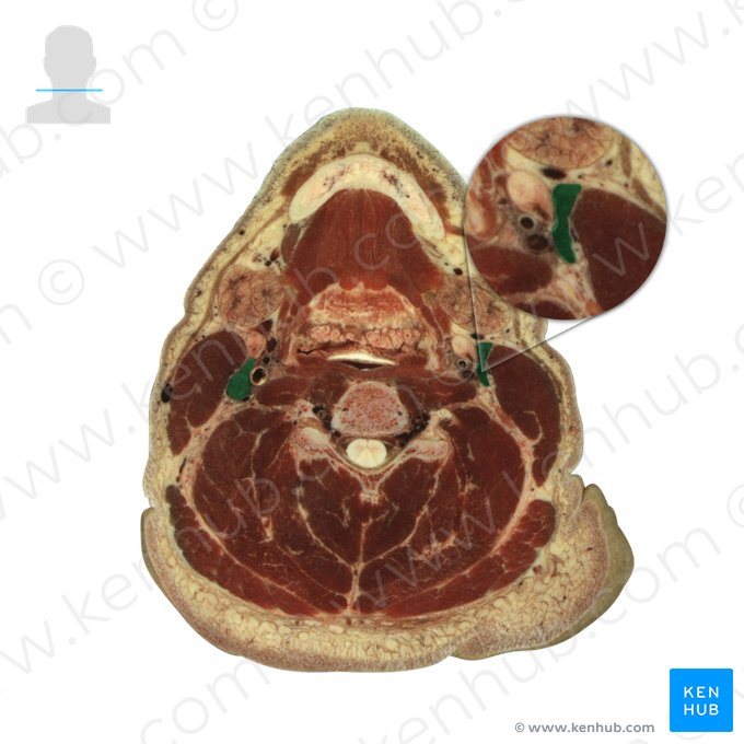 Veia jugular interna (Vena jugularis interna); Imagem: National Library of Medicine