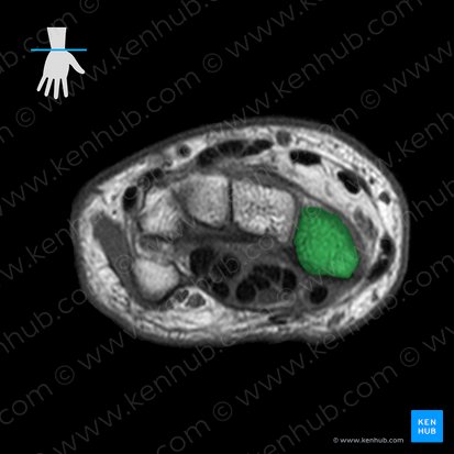 Scaphoid bone (Os scaphoideum); Image: 