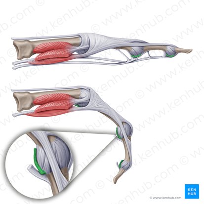 Ligamentum palmare (Hohlhandseitiges Band); Bild: Paul Kim