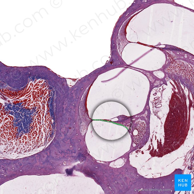Membrana basilar (Lamina basilaris ducti cochlearis); Imagem: 