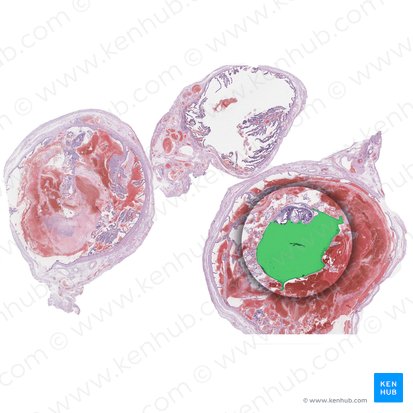 Amniotic sac (Saccus amnii); Image: 