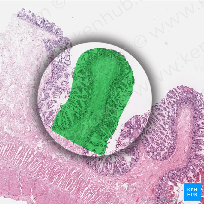 Pliegues circulares (Plicae circulares); Imagen: 