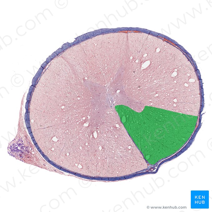 Funículo anterior da medula espinal (Funiculus anterior medullae spinalis); Imagem: 