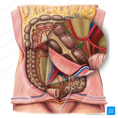 Arteria caecalis posterior (Hintere Blinddarmarterie); Bild: Irina Münstermann