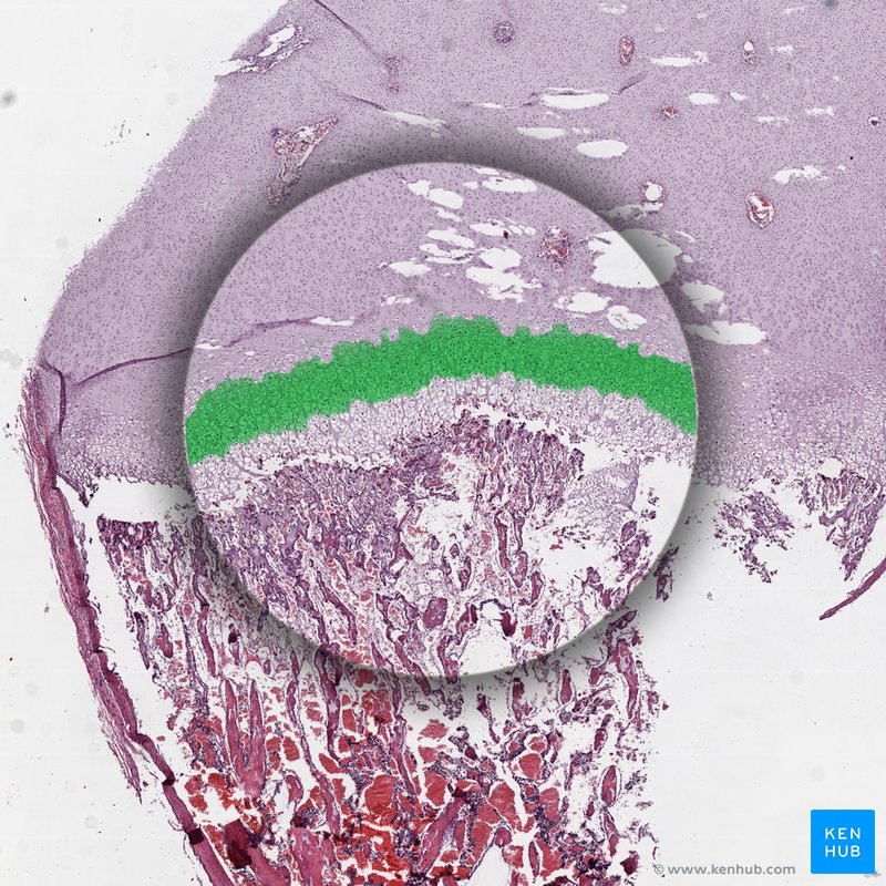 Zone of Proliferation - histological slide