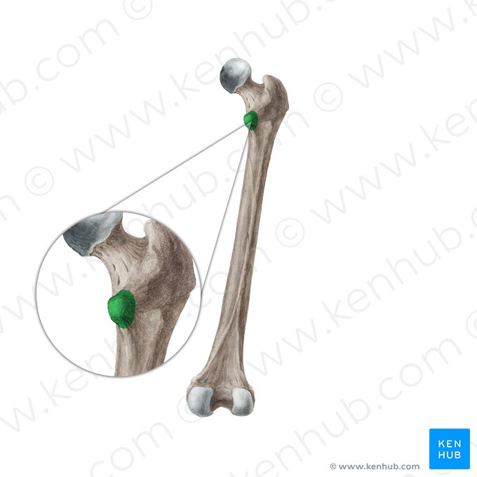 Lesser trochanter of femur (Trochanter minor ossis femoris); Image: Liene Znotina