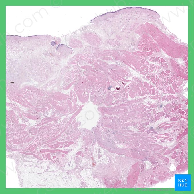 Urinary bladder (Vesica urinaria); Image: 