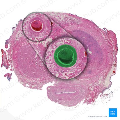 Deep dorsal vein of penis (Vena dorsalis profunda penis); Image: 