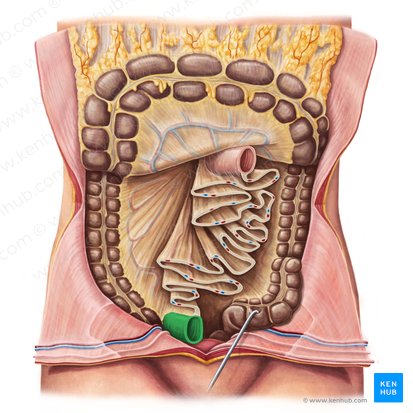 Ileum (Krummdarm); Bild: Irina Münstermann