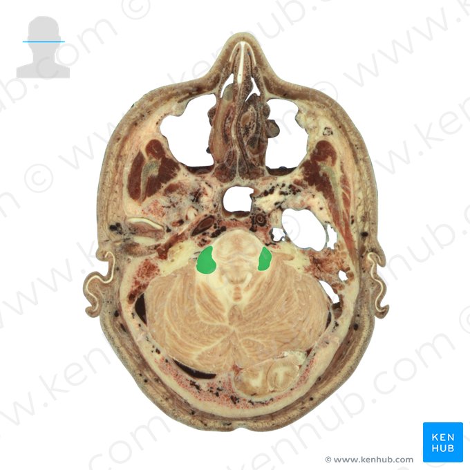 Middle cerebellar peduncle (Pedunculus cerebellaris medius); Image: National Library of Medicine