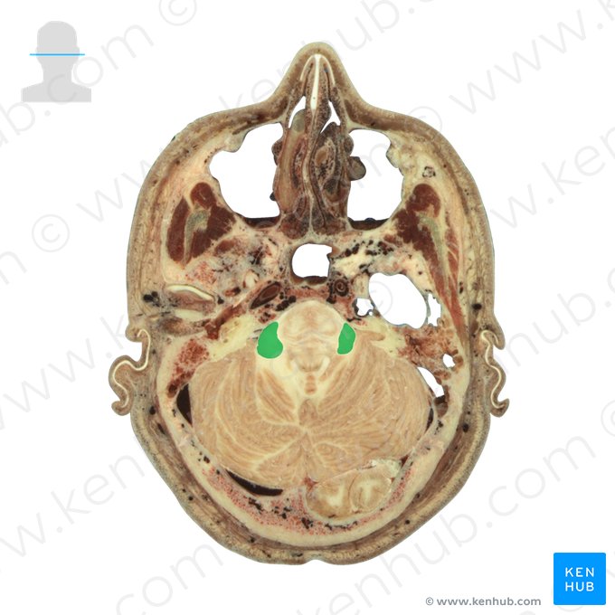 Pedúnculo cerebelar médio (Pedunculus cerebellaris medius); Imagem: National Library of Medicine