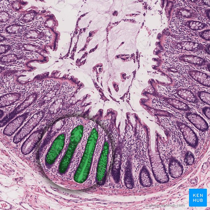 Cripta intestinal (de Lieberkühn) (Crypta intestinalis); Imagen: 