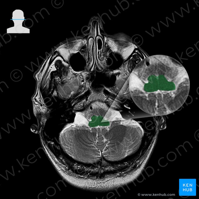 Medulla oblongata; Image: 