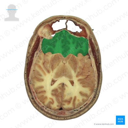 Frontal lobe (Lobus frontalis); Image: National Library of Medicine