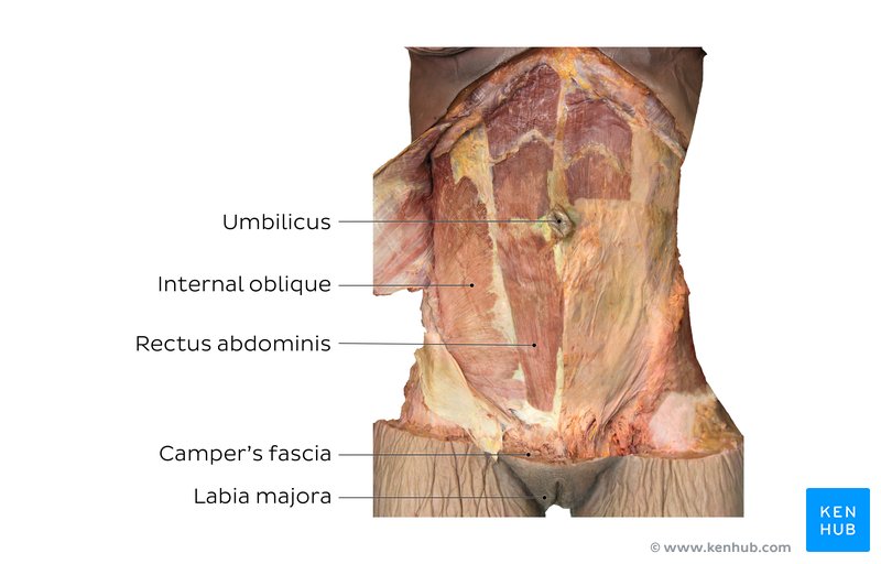 Anterior abdominal wall cadaver