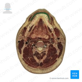 Orbicularis oris muscle (Musculus orbicularis oris); Image: National Library of Medicine