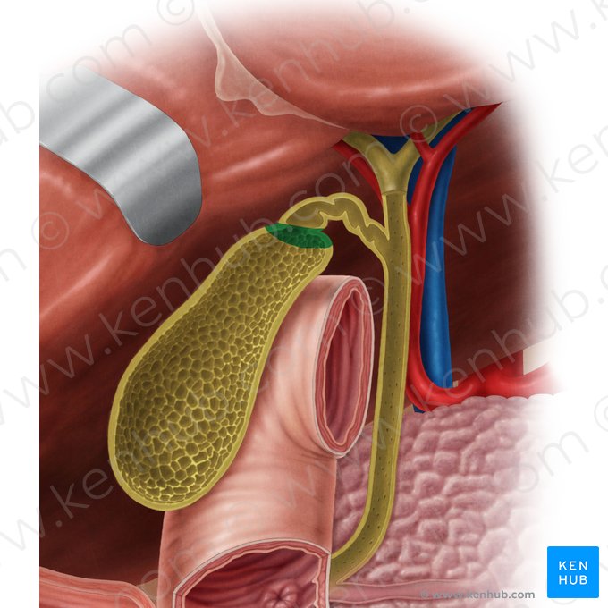 Infindibulum de la vésicule biliaire (Infundibulum vesicae biliaris); Image : Samantha Zimmerman