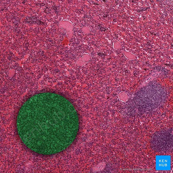 Reticular connective tissue; Image: 