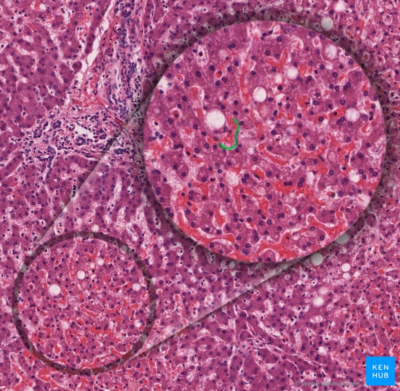 Space of Disse - histological slide