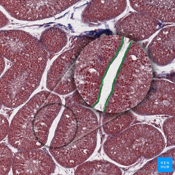 Basement membrane (Membrana basalis); Image: 