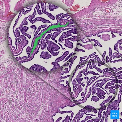 Lymphatic vessel (Vas lymphaticum); Image: 