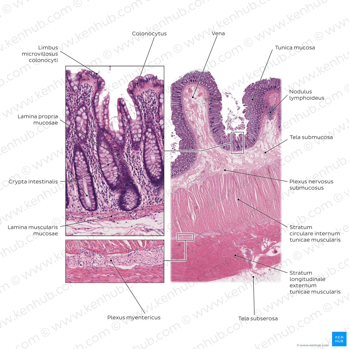 Colon (Färbung: Hämatoxylin-Eosin; links: niedrige Vergrößerung, rechts: hohe Vergrößerung)